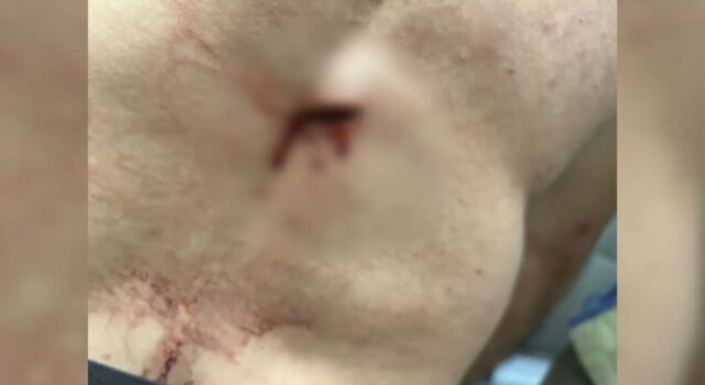 Sorriso: Homem sai com amigos, “enche a cara” de cachaça, chega em casa, discute e tenta bater em esposa e leva uma facada dela “pra ficar esperto”