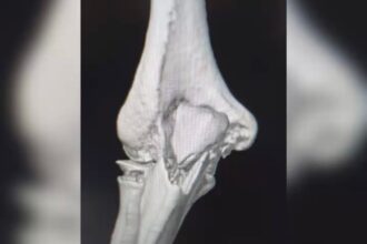 Sorriso: Energisa é condenada a pagar R$ 10 mil a mulher que caiu de moto e teve fratura por causa de fios soltos