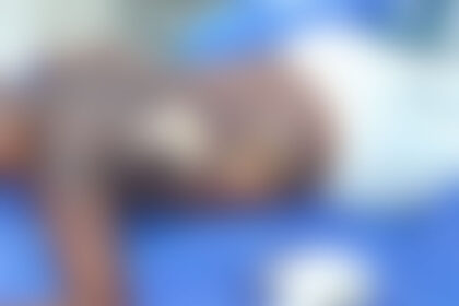 Sorriso: Criança tem corpo queimado com gasolina após ir brincar com amigos, suspeitos ainda gravaram vídeo de menino pegando fogo e pai acha que pode ser vingança