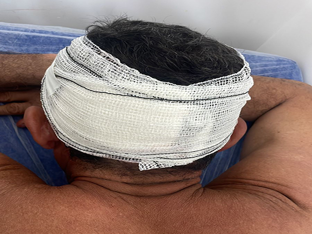 Sorriso: Homem é baleado na cabeça quando estava em bar na Rua Turmalinas; suspeito foi rejeitado pelas meninas do bar e voltou atirando