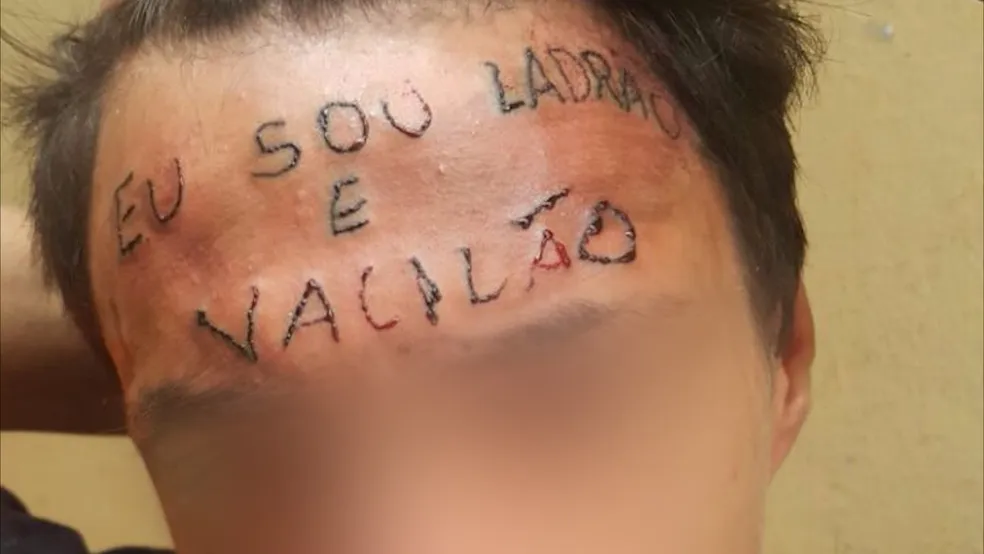 Jovem que teve testa tatuada com frase ‘eu sou ladrão e vacilão’ é preso de novo por furtar unidade de saúde