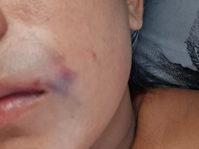 Sorriso: Homem não aceita separação e agride ex-mulher após vê-la com outro em bar