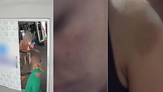 Sorriso: Promotora pede absolvição de homem que bateu na mulher com taco de sinuca