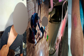 Sorriso: Doente, marido pede para esposa levar filhas na UPA, ela não vai e quando ele estava levando foi agredido por ela; mulher não queria parar de beber cachaça