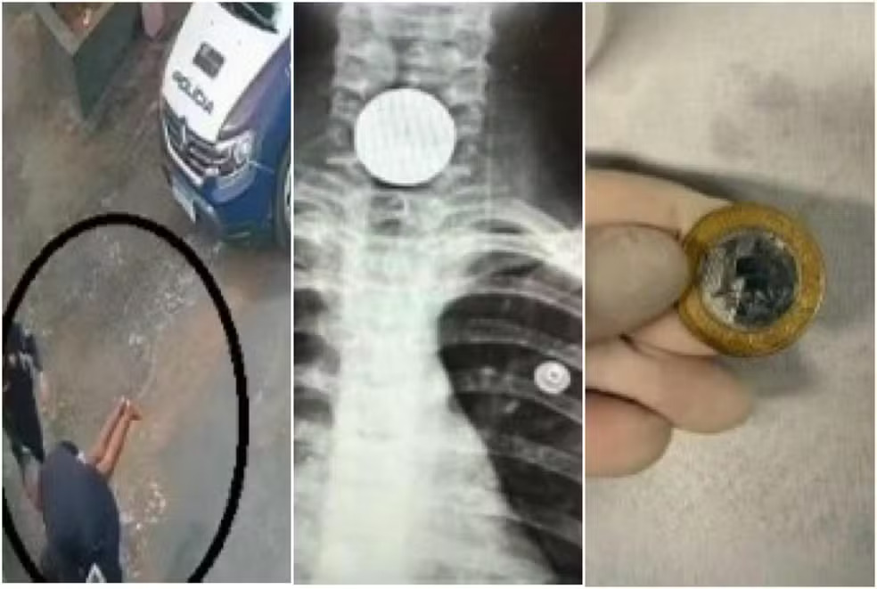 MT: PM socorre menina, de 7 anos, que se engasgou com moeda de 1 real
